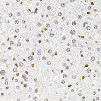 RPS6KA3 / RSK2 Antibody