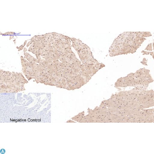 DES / Desmin Antibody