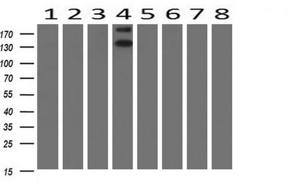 ERBB2 / HER2 Antibody (aa676-1255, clone OTI4F10, Carrier-free)