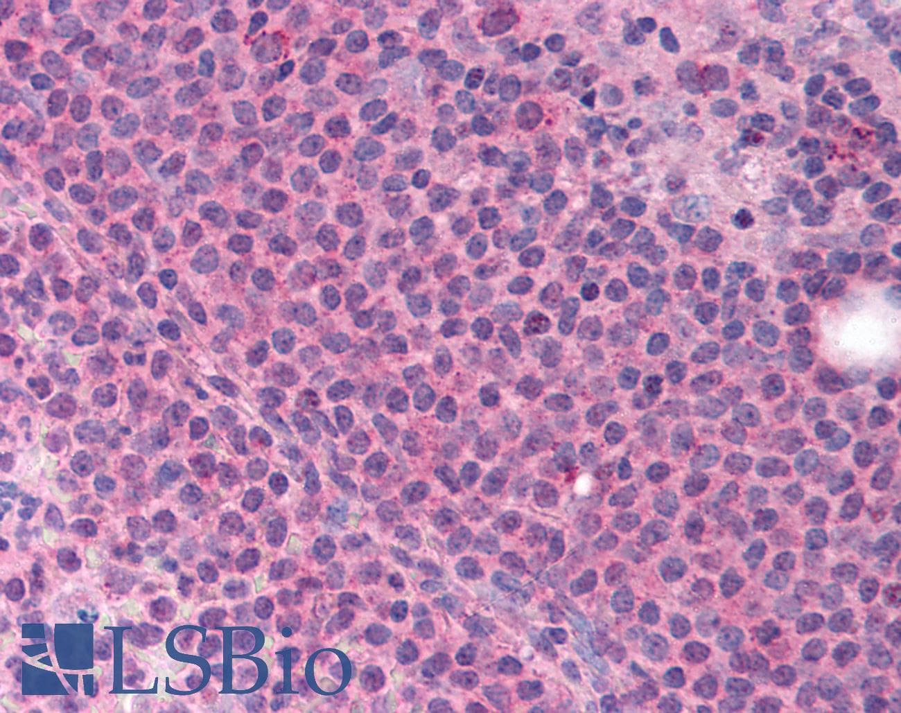 IHC-plus™ Polyclonal Rabbit anti-Human MLLT4 / Afadin Antibody (aa1582-1597, IHC)