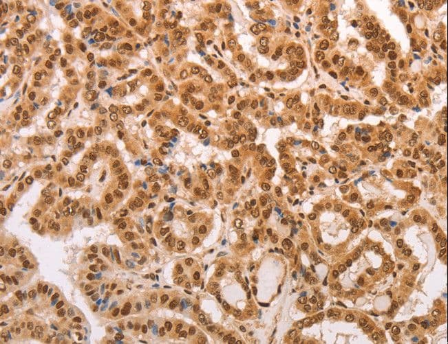 Polyclonal Rabbit anti-Human HEXIM1 Antibody (IHC)