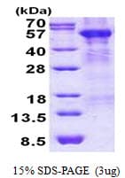 Human ARSA / Arylsulfatase A Protein (Recombinant His)