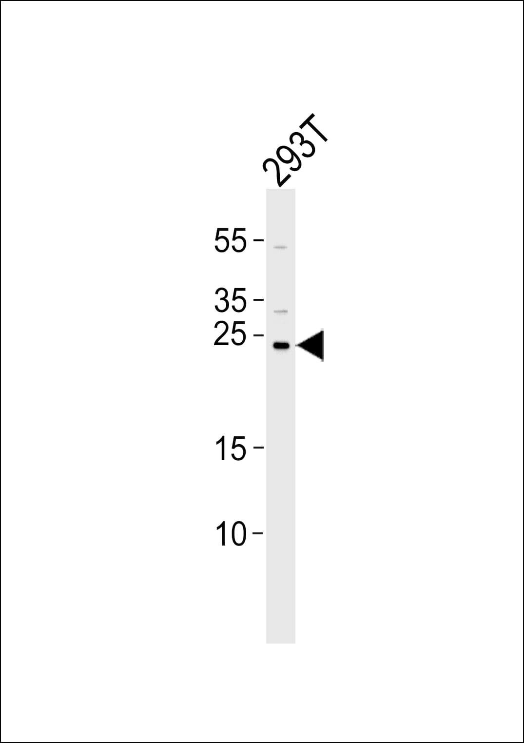 Polyclonal Rabbit anti-Human CHCHD3 Antibody (aa83-116, WB)