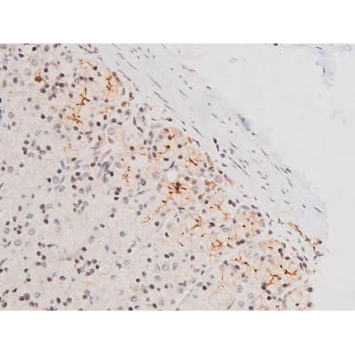 MAPK8 / JNK1 Antibody (phospho-Thr183,pTyr185)
