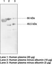 Polyclonal Rabbit anti-Human LCAT Antibody (WB)