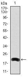 Monoclonal Mouse anti-Human LRP5 Antibody (clone 2B11, WB)