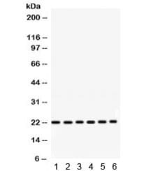 RAB10 Antibody