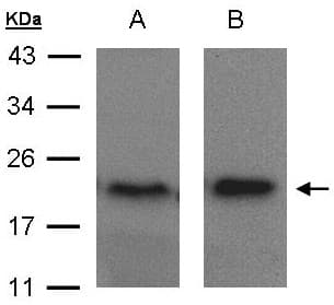 Polyclonal Rabbit anti-Human ARF5 Antibody (aa49-180, WB)