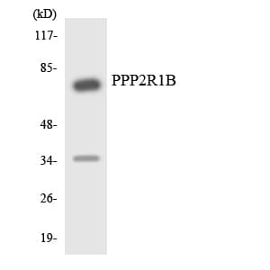 PPP2R1B Antibody (aa541-590)