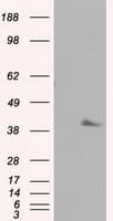PLEK / Pleckstrin Antibody (clone OTI2F10)