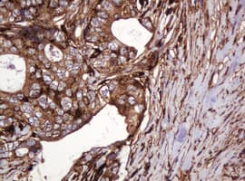 ATP6V1B2 Antibody (clone 1.00E+11, Carrier-free)