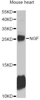 Polyclonal Rabbit anti-Human NGF Antibody (IHC, WB)