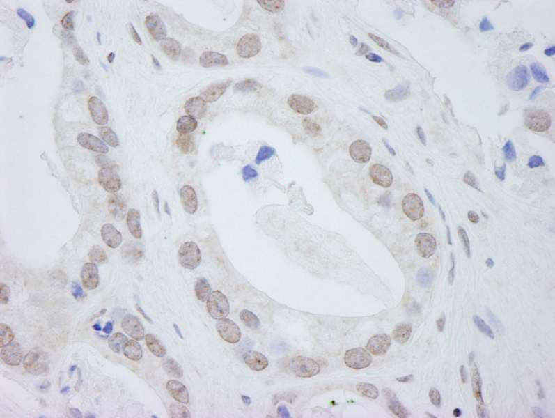DDX24 Antibody (aa800-C-term)