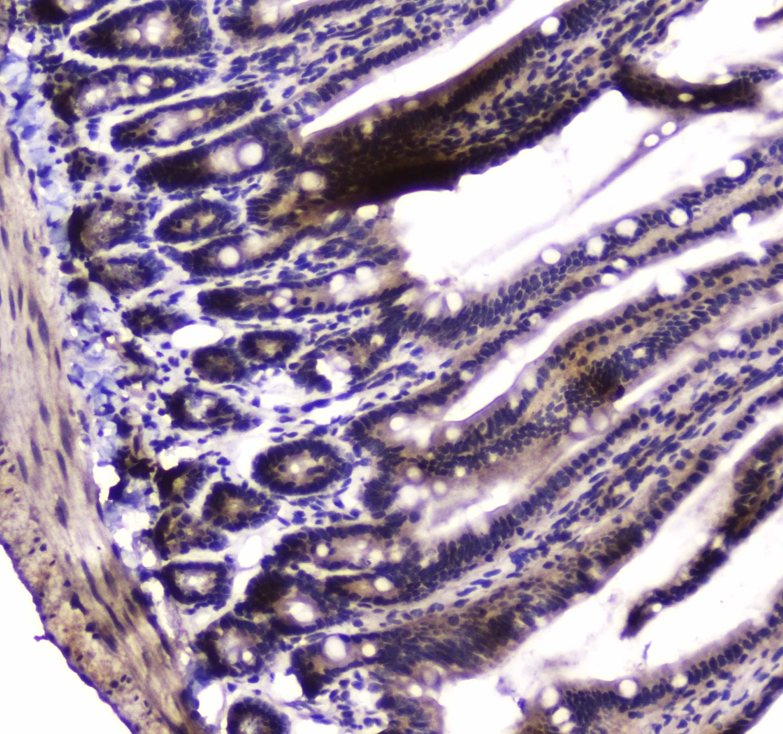 PARN Antibody