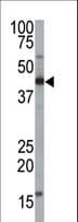 Polyclonal Rabbit anti-Human PTAR2 / FNTA Antibody (aa88-118, WB)