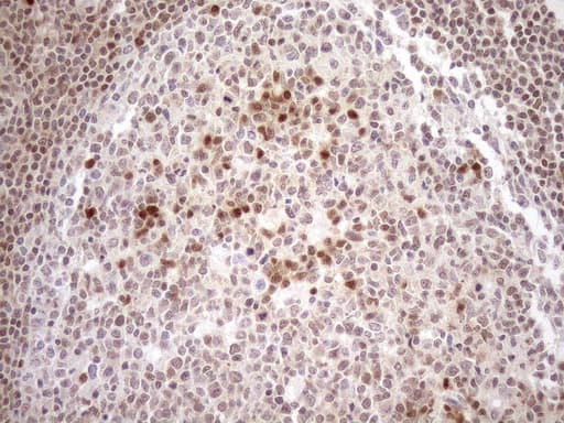 Monoclonal Mouse anti-Human MGMT Antibody (clone OTI2F10, IHC, WB)