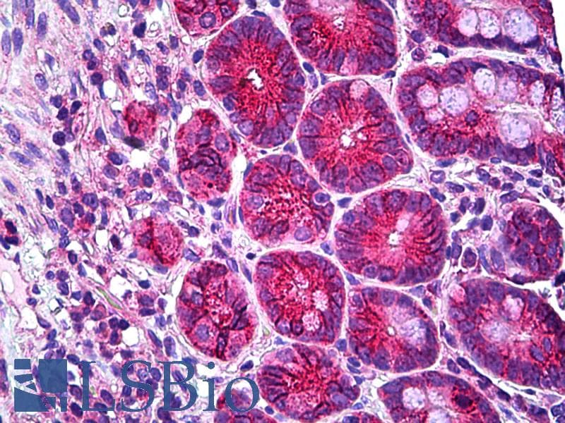 IHC-plus™ TTF / RHOH Antibody (aa141-190)