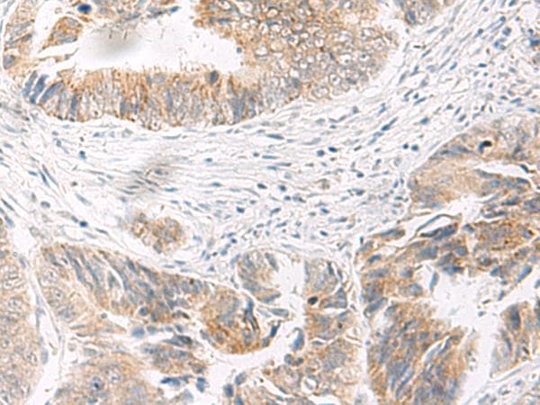 IDUA / MPS1 Antibody