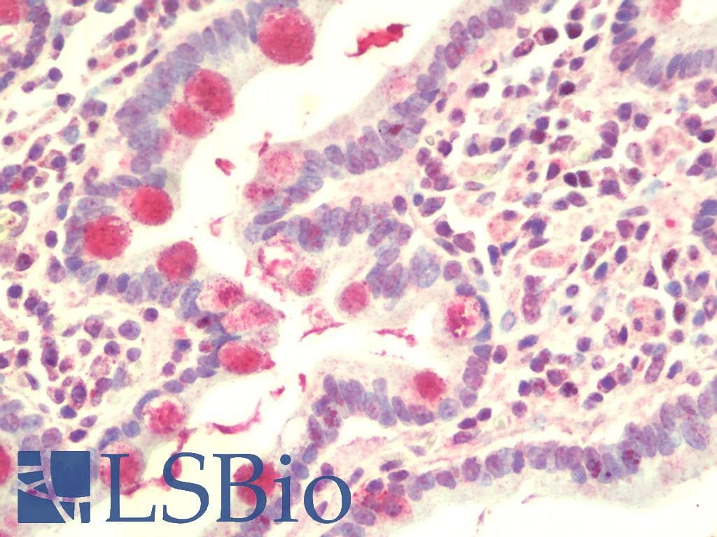 IHC-plus™ Polyclonal Chicken anti-Human SPINK7 / ECRG2 Antibody (IHC, WB)