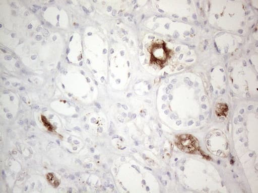 ANPEP / CD13 Antibody (aa668-967, clone OTI2E4)