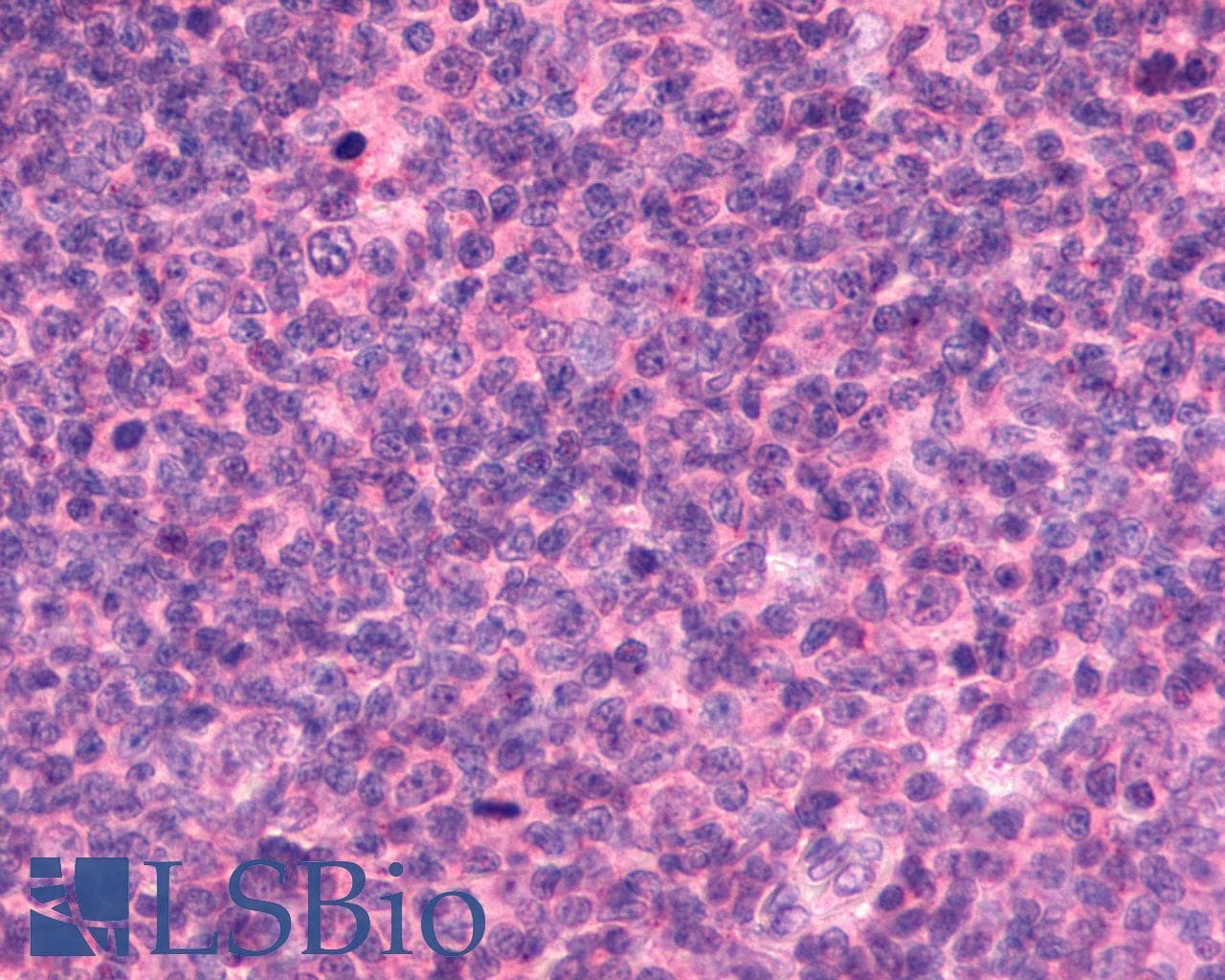 PathPlus™ Polyclonal Rabbit anti-Human ADGRE2 / EMR2 Antibody (N-Terminus, IHC)
