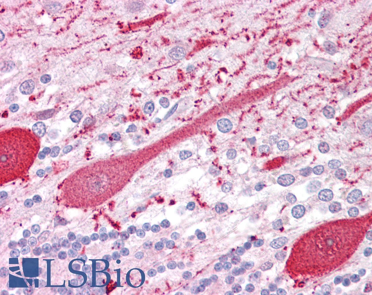 PathPlus™ RET Antibody (aa1012-1042)