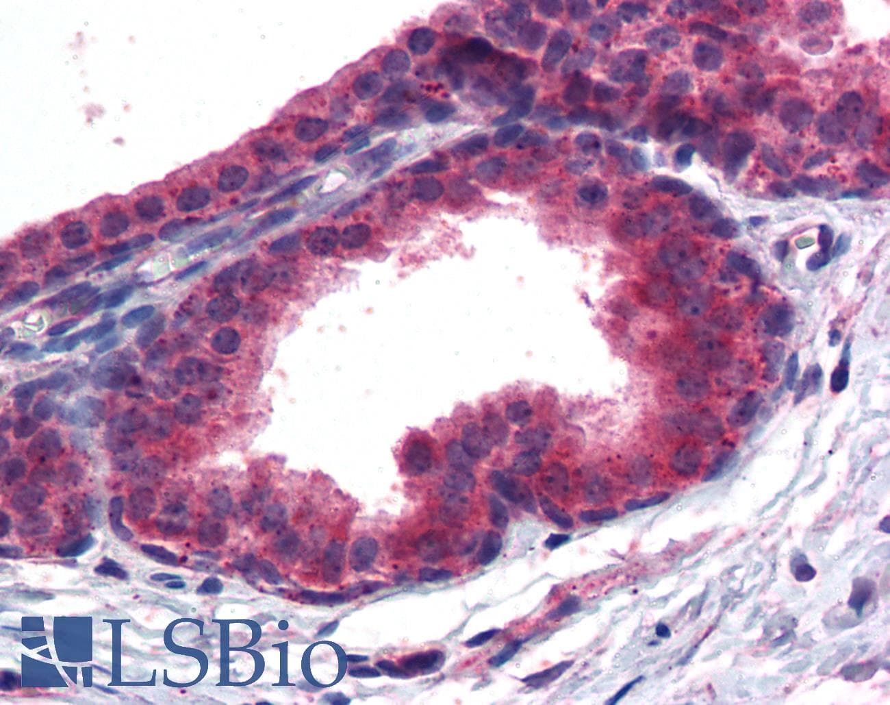 IHC-plus™ Polyclonal Goat anti-Human PPARD / PPAR Delta Antibody (aa430-441, IHC, WB)