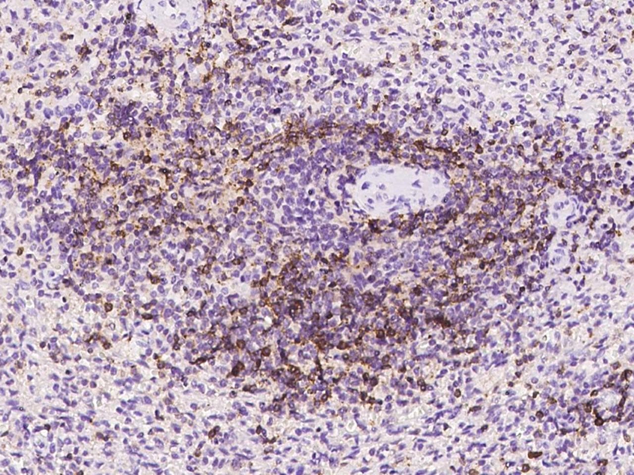 CD6 Antibody