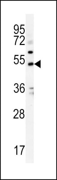 Polyclonal Rabbit anti-Human KCNJ6 / GIRK2 Antibody (aa26-55, IHC, WB)