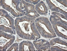 Monoclonal Mouse anti-Human UBE2J1 Antibody (clone OTI3C11, IHC, WB)