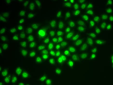 SMARCE1 / BAF57 Antibody