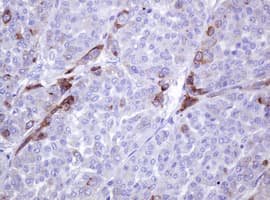 ABCB1 / MDR1 / P Glycoprotein Antibody (aa995-1280, clone OTI2G6, Carrier-free)