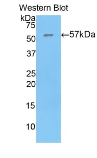 THBS4 / Thrombospondin 4 Antibody (aa662-923, Biotin)