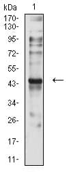 CCR7 Antibody (clone 7A5A9)
