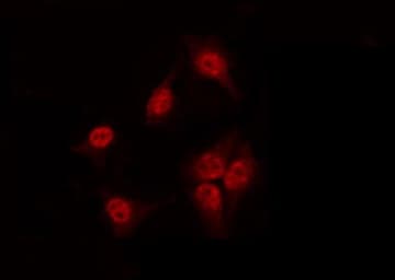Polyclonal Rabbit anti-Human SOX9 Antibody (phospho-Ser181, IHC, IF, WB)