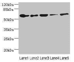 Polyclonal Rabbit anti-Human CHRNA6 Antibody (IHC, WB)
