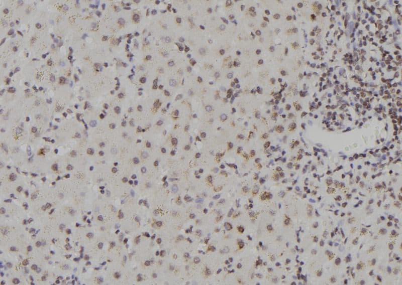 Polyclonal Rabbit anti-Human ZNF709 Antibody (IHC, WB)