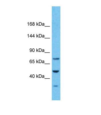 PKD2 / Polycystin 2 Antibody (aa196-245)