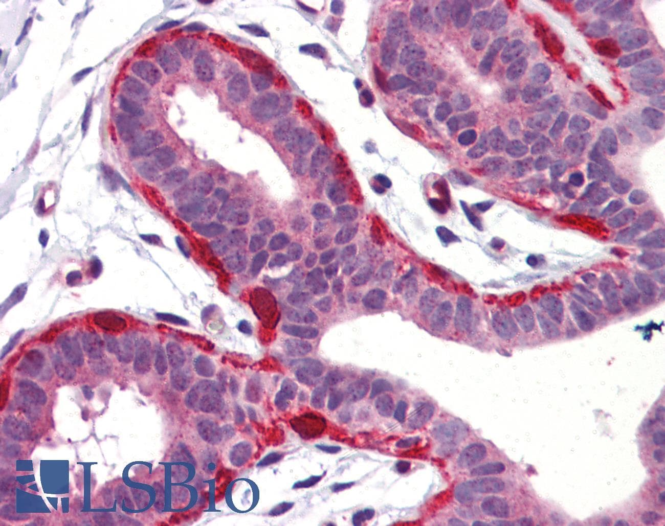 IHC-plus™ Polyclonal Rabbit anti-Human SNCG / Gamma-Synuclein Antibody (IHC, WB)
