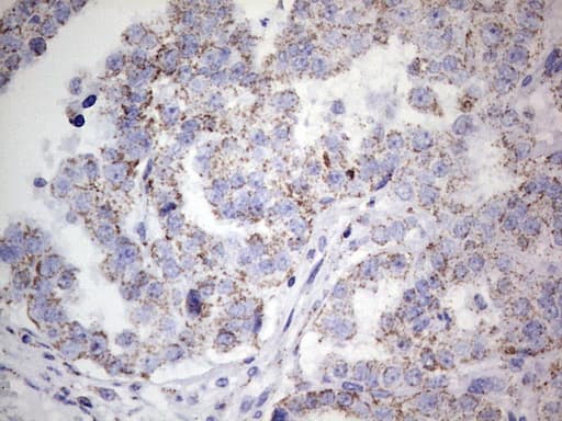 PIK3CD / PI3K Delta Antibody (aa286-610, clone OTI2H3)