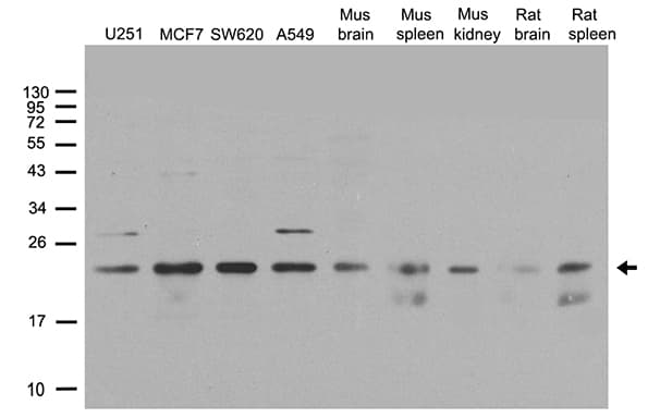 Polyclonal Rabbit anti-Human POLR2G / RPB7 Antibody (WB)