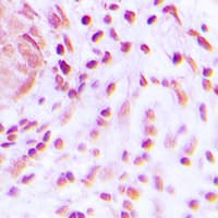 Polyclonal Rabbit anti-Human BARD1 Antibody (N-Terminus, IHC, WB)