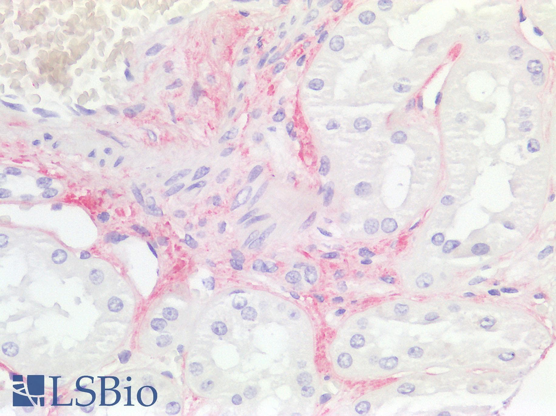 IHC-plus™ GDF15 Antibody (C-Terminus, clone 6D12.H10.E4)