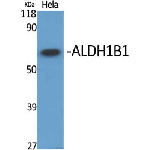 ALDH1B1 Antibody (280-360 aa, Internal)