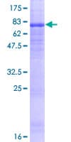 Human ATG18 / WIPI1 Protein (Recombinant GST)