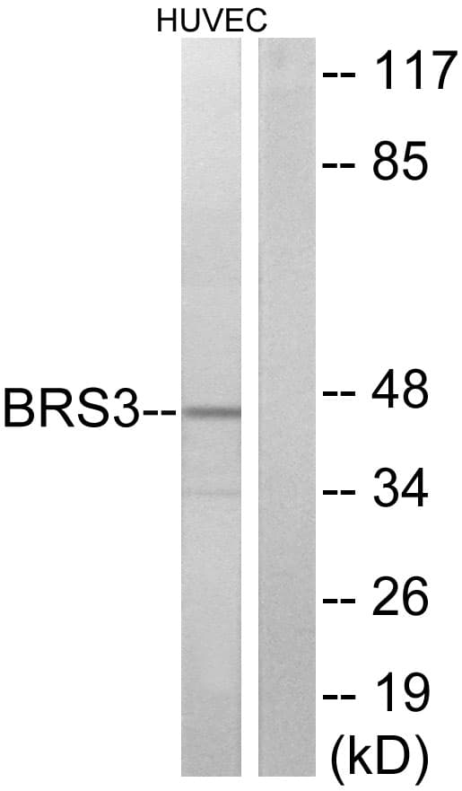 BRS3 Antibody (aa161-210)