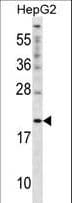 CYGB / Cytoglobin Antibody (aa1-30)