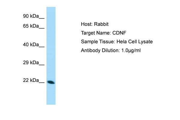 CDNF / ARMETL1 Antibody (aa52-101)