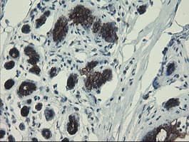 DPH2 Antibody (clone OTI3A12)