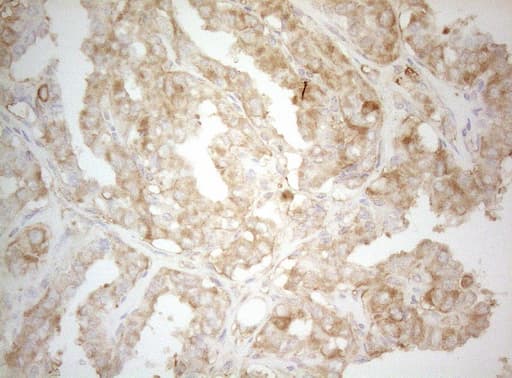 TWF1 / PTK9 Antibody (aa140-384, clone OTI5C12)